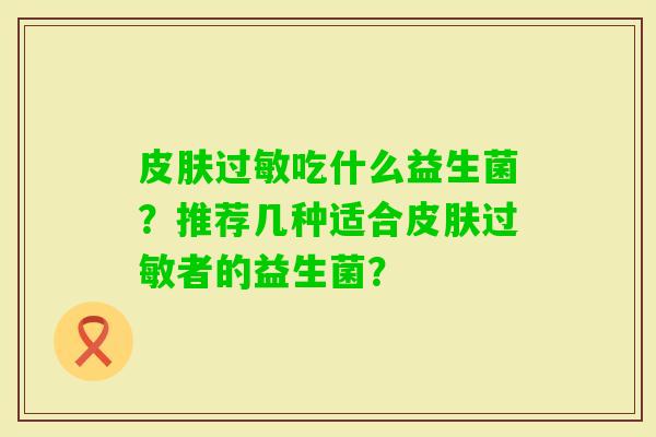 吃什么益生菌？推荐几种适合者的益生菌？