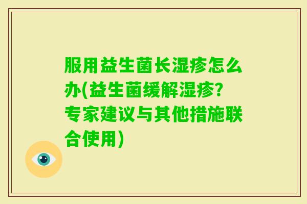 服用益生菌长怎么办(益生菌缓解?专家建议与其他措施联合使用) 服用益生菌长怎么办(益生菌缓解?专家建议与其他措施联合使用)